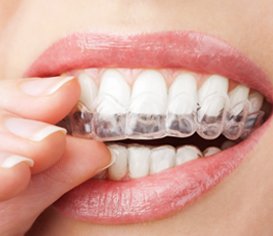 Servicio Dental Monterrey